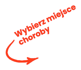 Wybierz miejsce choroby